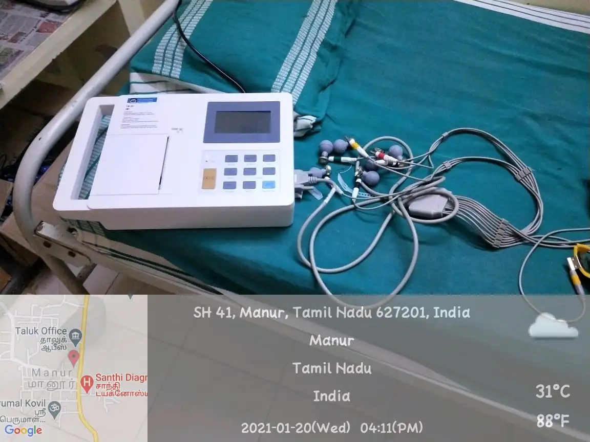 Patient Monitor System